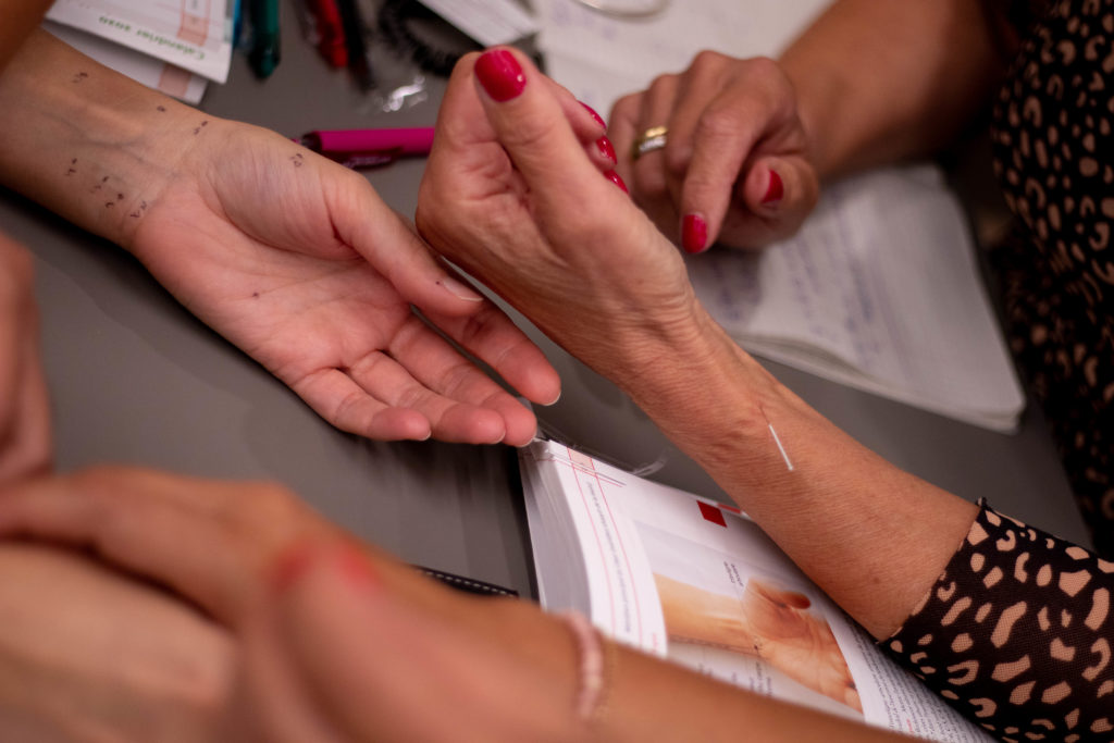 Accupuncture formations